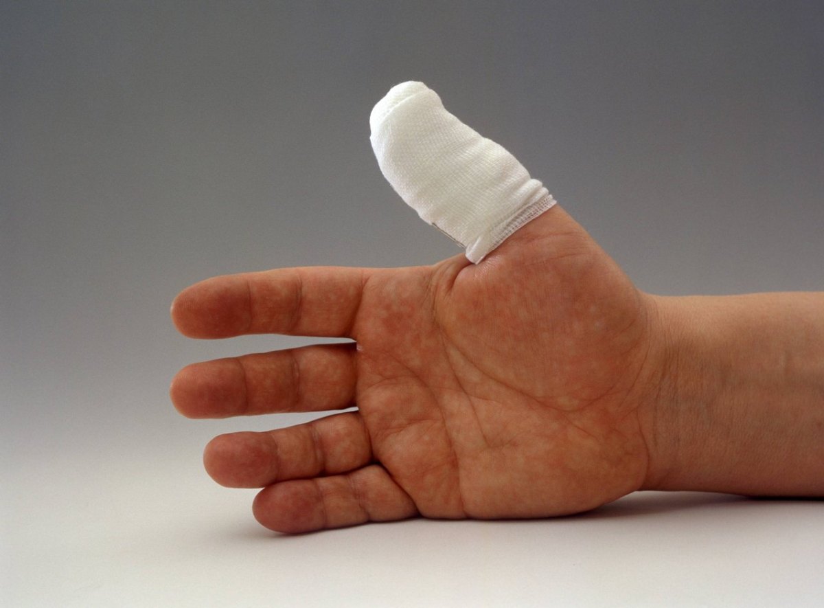 Hand Verletzung