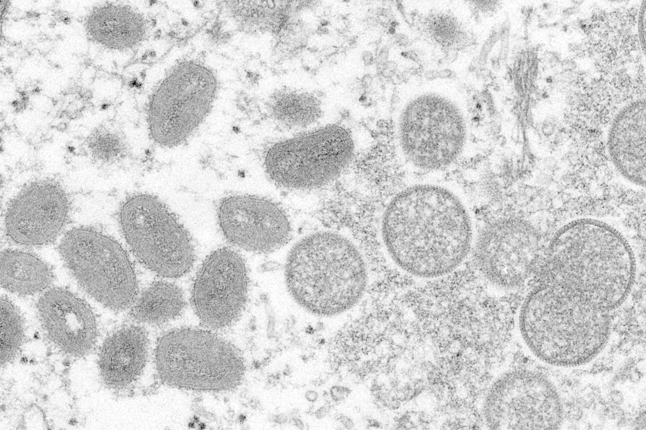 Thüringen: So sehen die Affenpockenviren unter den Mikroskop aus. (Archivbild)